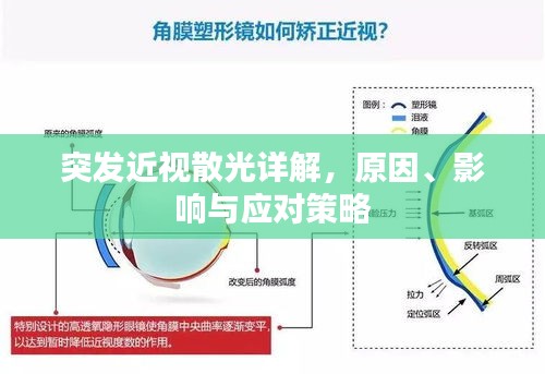 突發(fā)近視散光詳解，原因、影響與應對策略