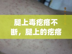 腿上毒疙瘩不斷，腿上的疙瘩特別特別多為什么 