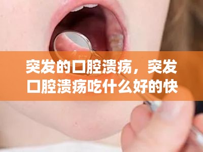 突發(fā)的口腔潰瘍，突發(fā)口腔潰瘍吃什么好的快 