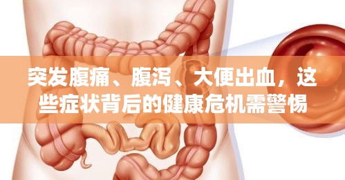 突發(fā)腹痛、腹瀉、大便出血，這些癥狀背后的健康危機(jī)需警惕！