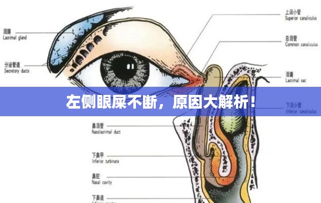 左側(cè)眼屎不斷，原因大解析！